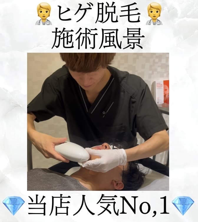 【メンズ脱毛】ヒゲ脱毛施術風景✅